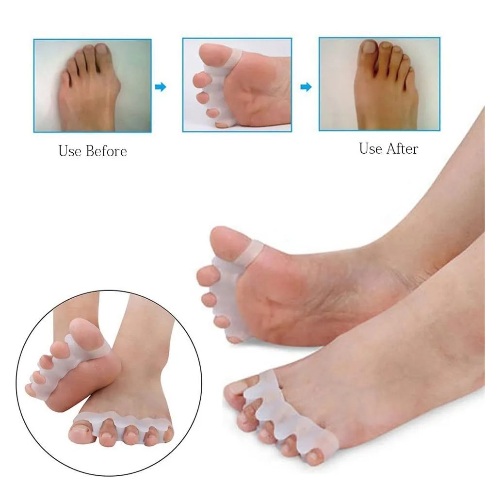 2 Pairs Toe Separators Soft Stretchable Toe Dividers Corrective Straightening Toe Dividers for Yoga Ballet and Running Overlapping Toes Hallux Valgus